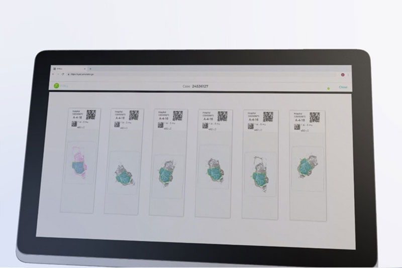 Representation of AI-based automatic transfer of ROI marking to dissection slides