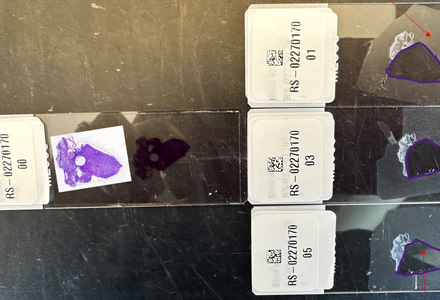 Labcorp Study Thumbnail